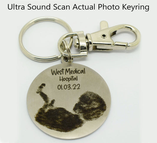 Double side Silver Gift Personalised Keyring Ultra Sound Scan New Baby Born design photo engraved Actual Photo